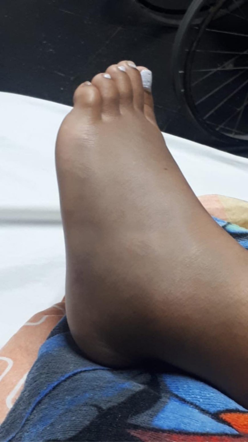 Joven de 21 años sufrió la mordedura de una serpiente