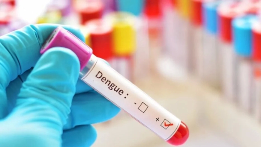 DENGUE - Anmat aprobó un nuevo kit para conocer el diagnóstico de dengue