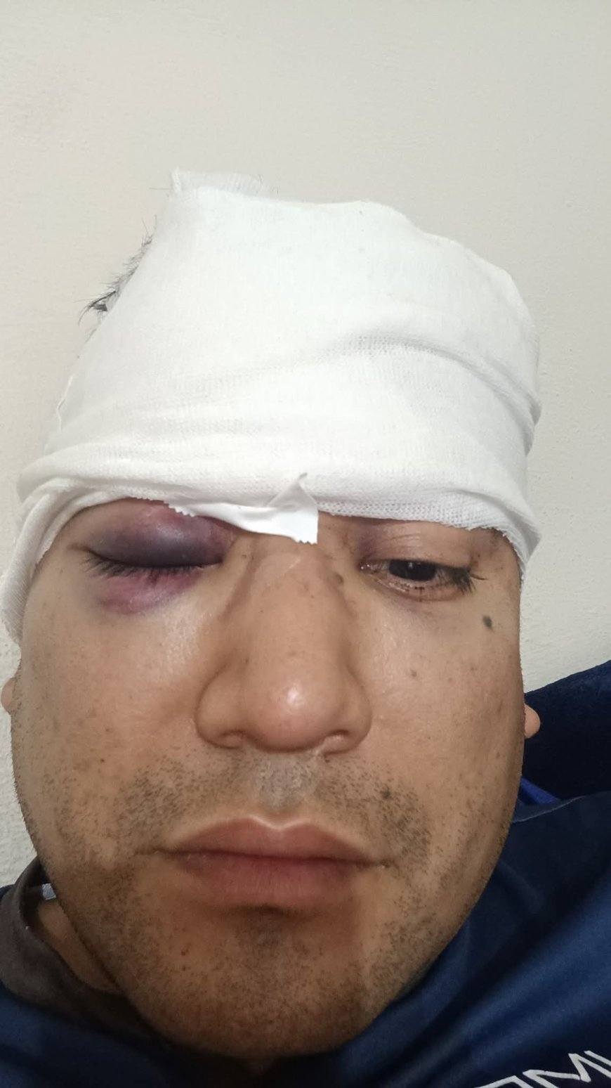 Rosario de Lerma: Denuncia Brutal Ataque en Rosario de Lerma