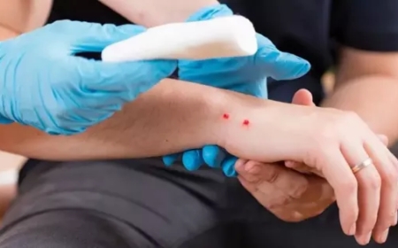 Salta ya registró más de 70 casos de mordeduras de víbora