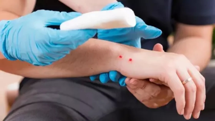 Salta ya registró más de 70 casos de mordeduras de víbora